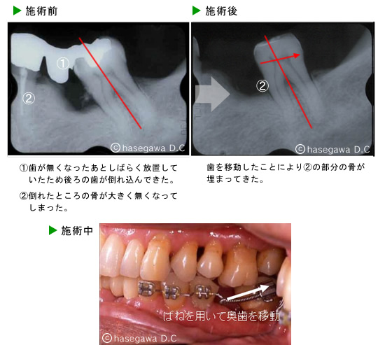 矯正歯科